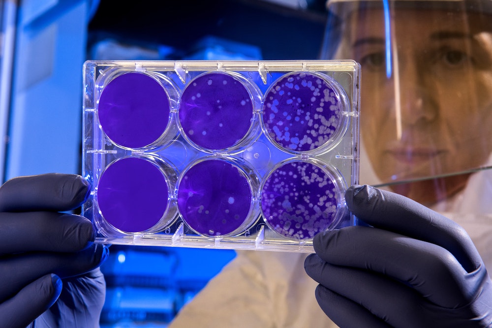 Coronavirus (COVID-19): What Is It and How Does It Spread?