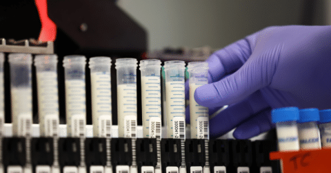 Milk samples in testing tubes