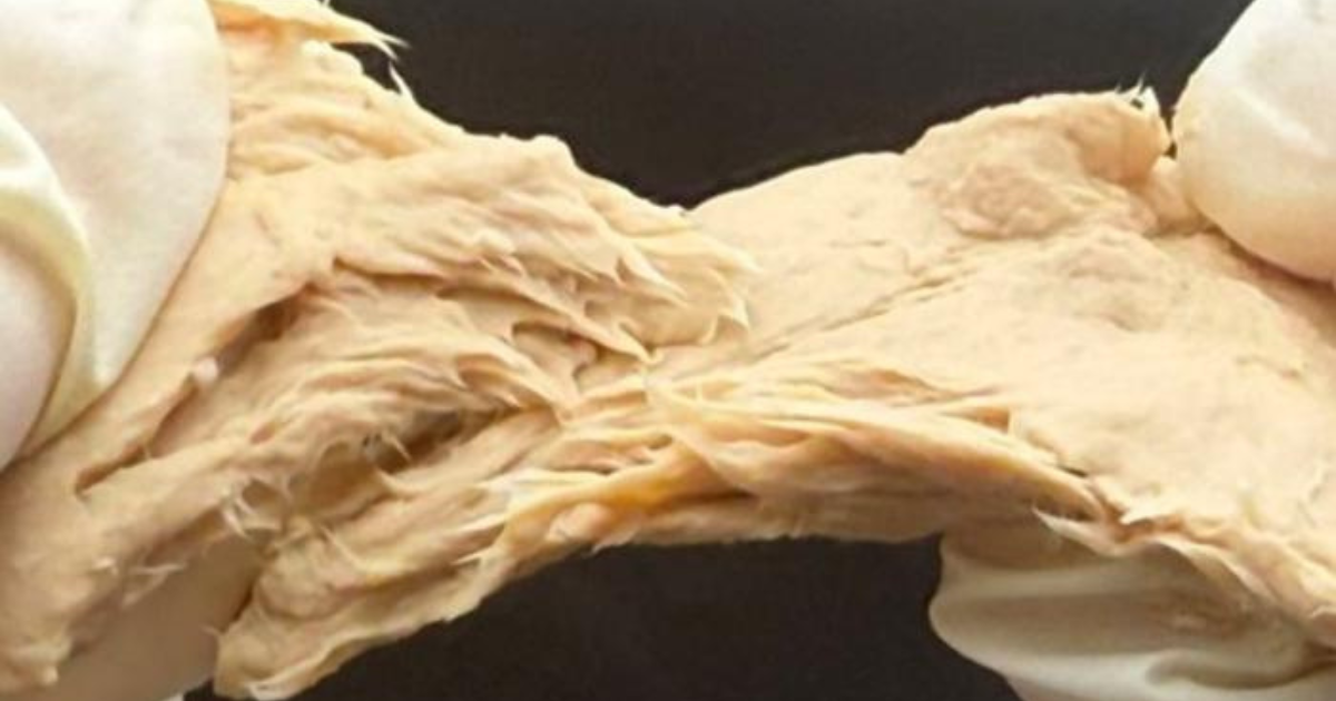 Could Genetically Engineered Fungus Help Replace Animal Protein?